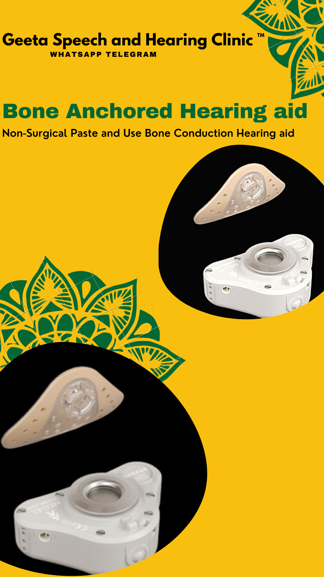 Bone anchored Hearing aid from GEETA SPEECH AND HEARING CLINIC