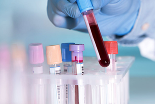 Haematology Tests from Dr. Panchal Lab and Diagnostics Centre