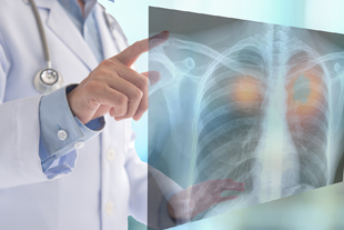 Digital X-rays from Dr. Panchal Lab and Diagnostics Centre